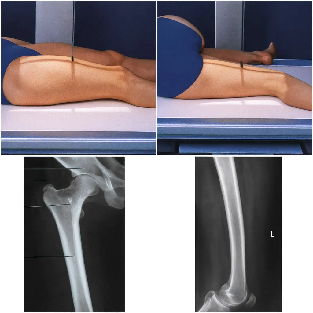 Femur (Paha)